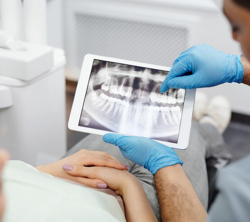dentist wearing gloves showing patient dental x-ray